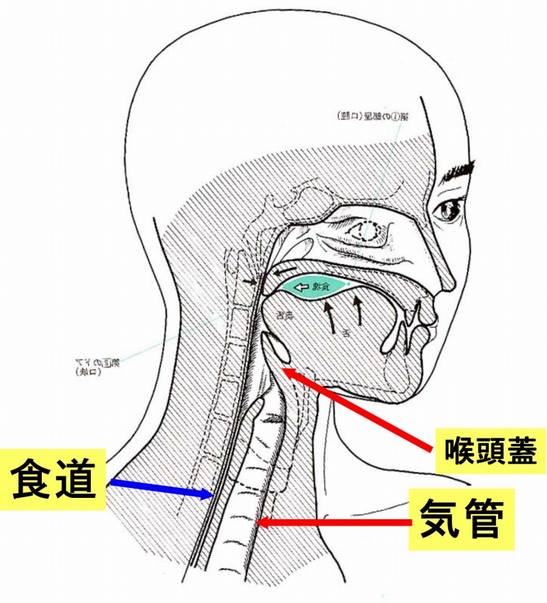 摂食・嚥下障害と誤嚥性肺炎